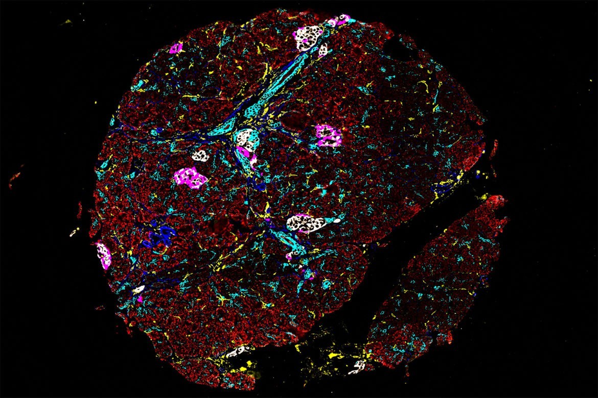 Interview: Anna Martinez Casals, Researcher at SciLifeLab